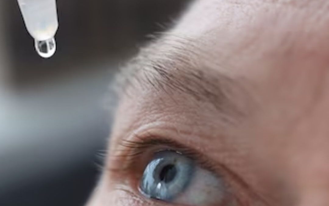 Best Eye Drops For Subconjunctival Hemorrhage
