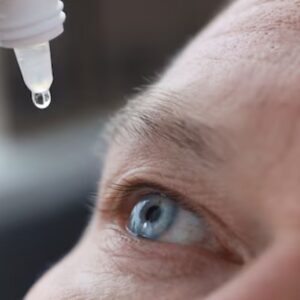 Best Eye Drops For Subconjunctival Hemorrhage